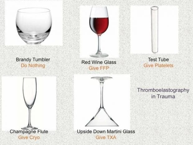 TEG-kurva förklaring